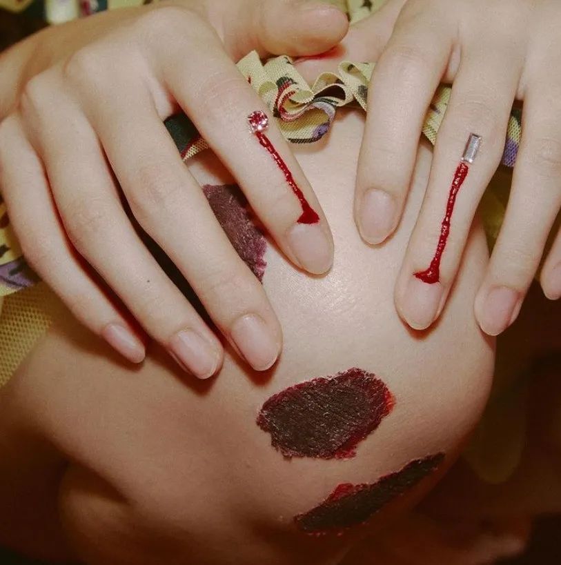 昨晚梦见自己手臂上有个伤口一直在流血，梦境背后的深层含义与解析