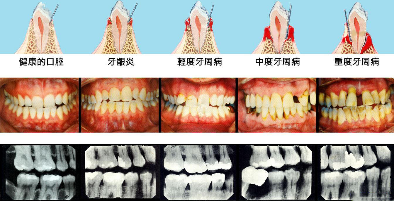 解梦，昨天做梦牙掉光了的深层含义与心理解析