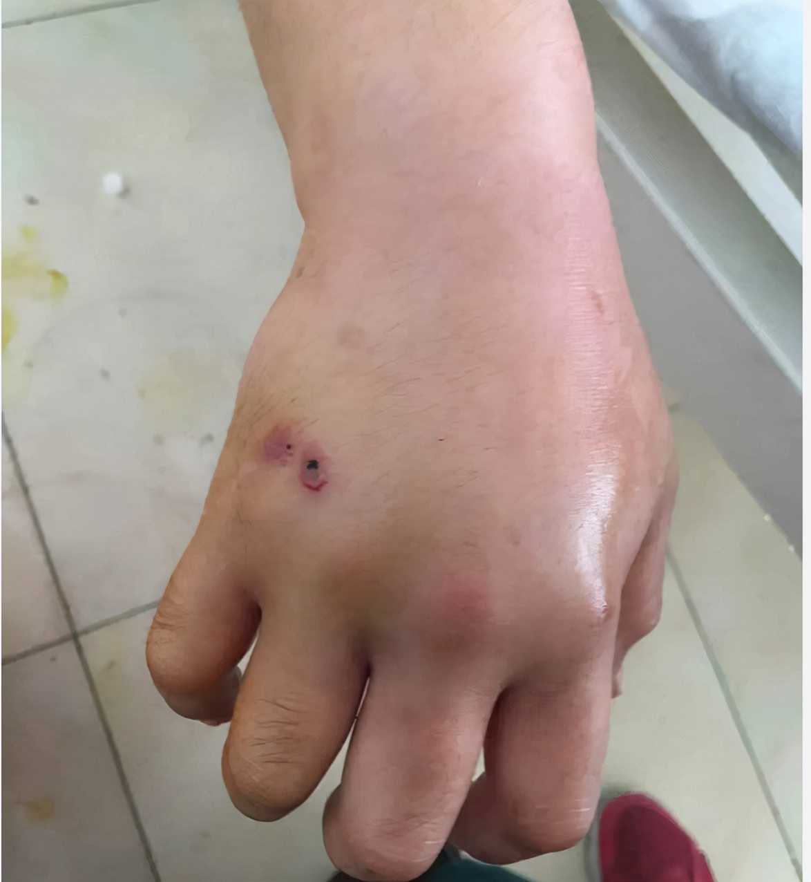 做梦梦见一条蛇但是它死了是什么征兆？