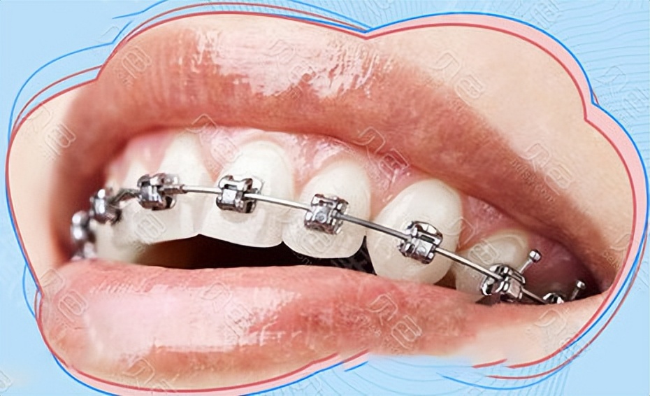 梦遇虎牙松动，未落之兆的深层解析——求大师真解