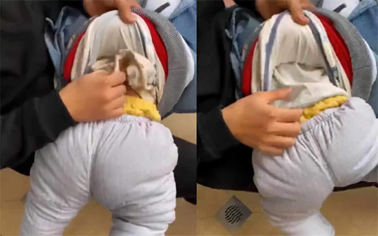 做梦梦见去世的奶奶胳膊断了，梦境背后的深层含义与心理解析