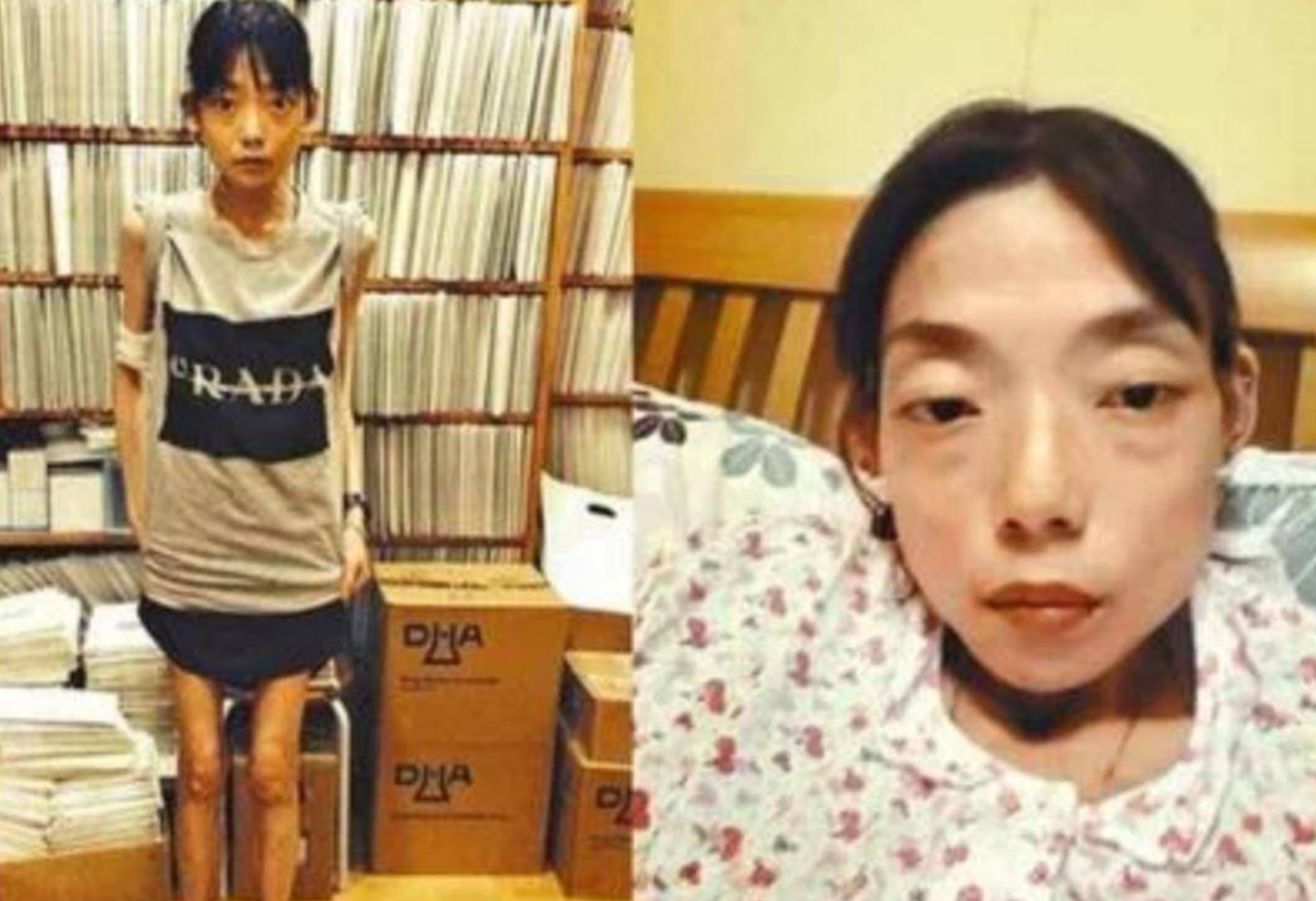 梦见别人牙齿掉光，梦境背后的深层含义与心理解析