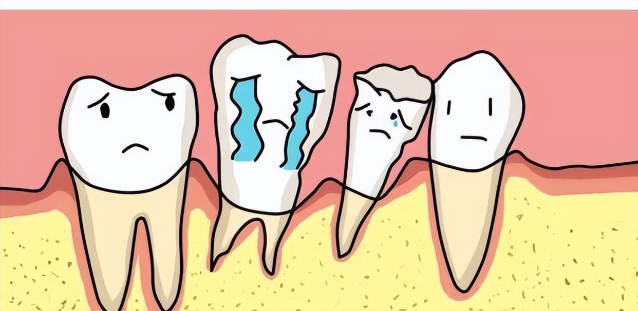 梦境解析，后半夜梦到自己牙齿松动的深层含义与心理解析