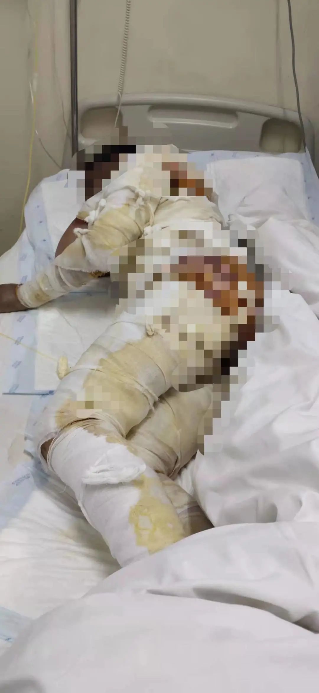 梦境解析，为何会梦到被子里有死人？